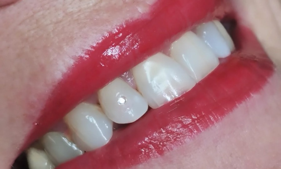 Sourire aux lèvres rouges, un bijou dentaire Swarovski sur une incisive latérale