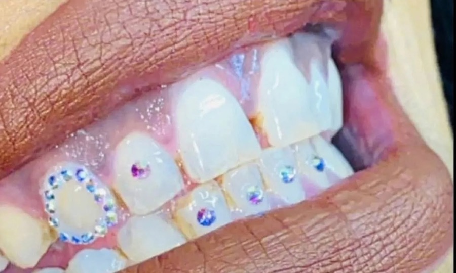 Plusieurs bijoux et strass dentaires sur les dents du haut, rouge à lèvres nude